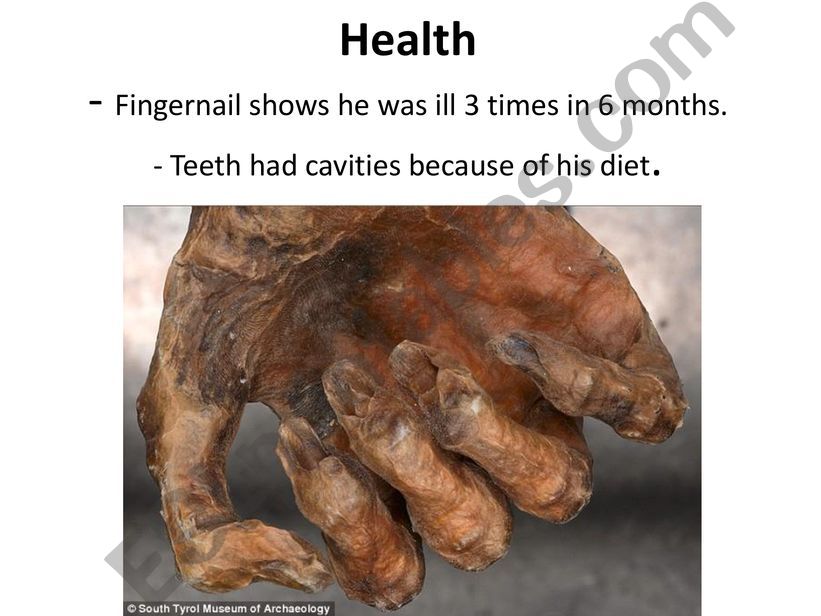 Esl English Powerpoints Otzi The Iceman