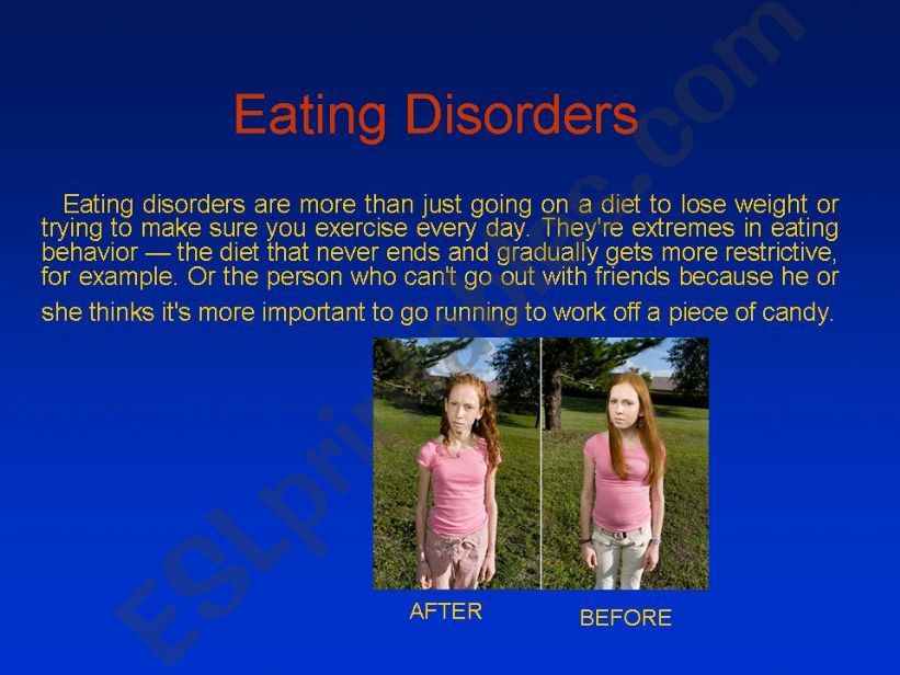 Eating Disorders powerpoint
