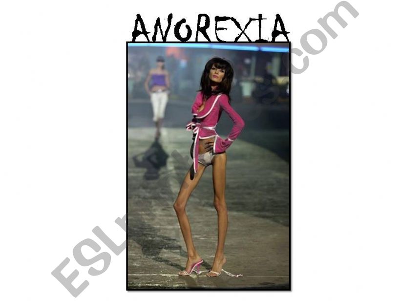 Anorexia powerpoint