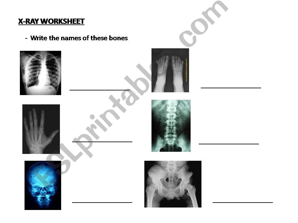 x ray worksheet powerpoint