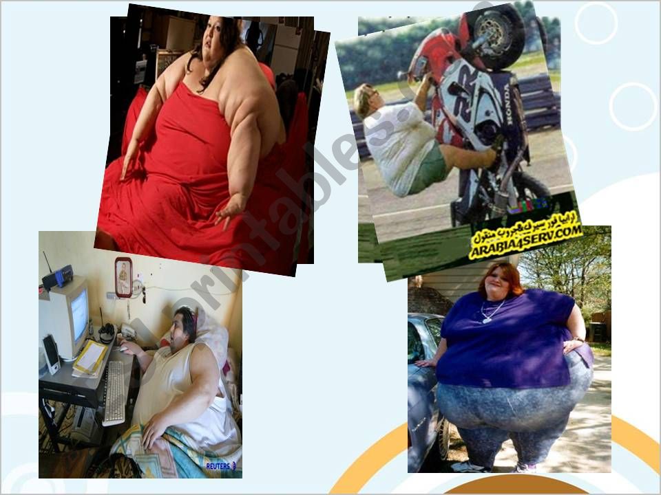 Obesity-causes-results-solution