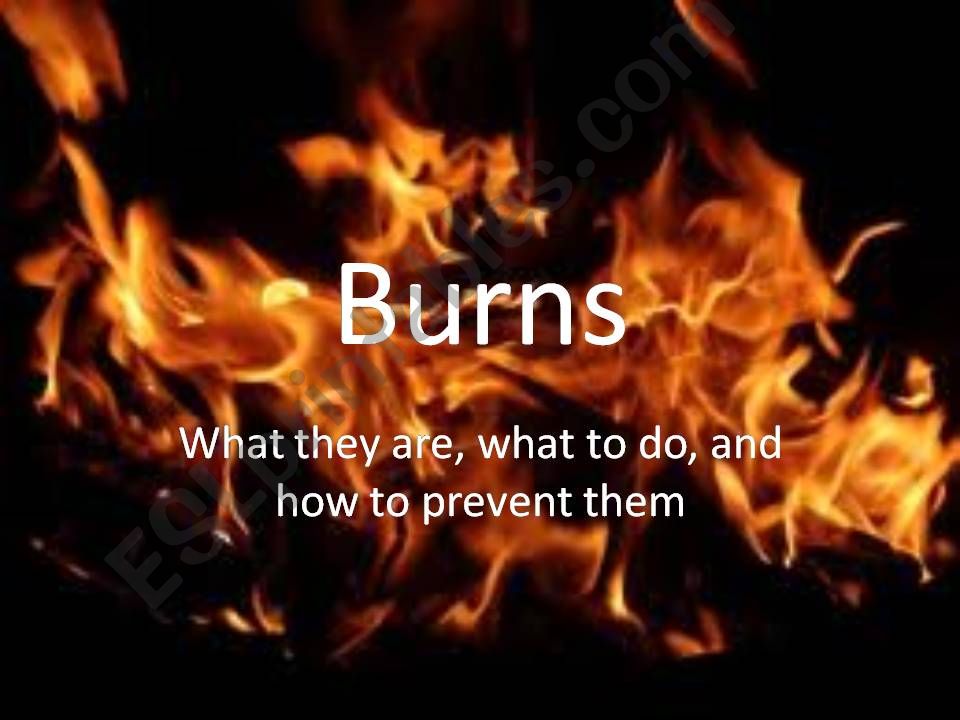 Burns powerpoint