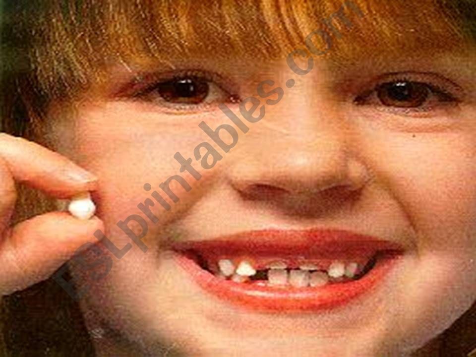 milk and permanent teeth powerpoint