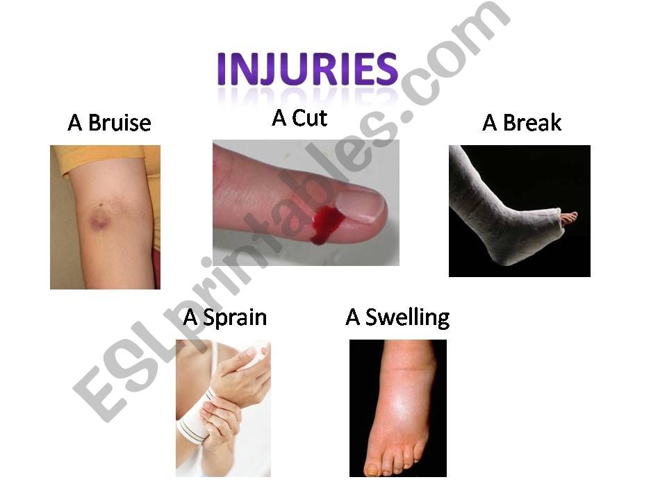 Injury powerpoint
