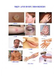 English Worksheet: Skin and Body Disorders