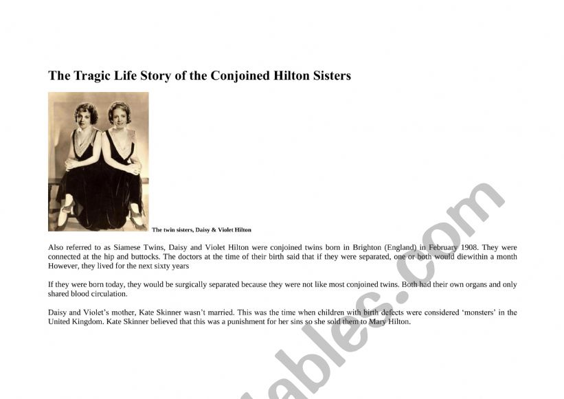 The tragic life of the Siamese sisters 