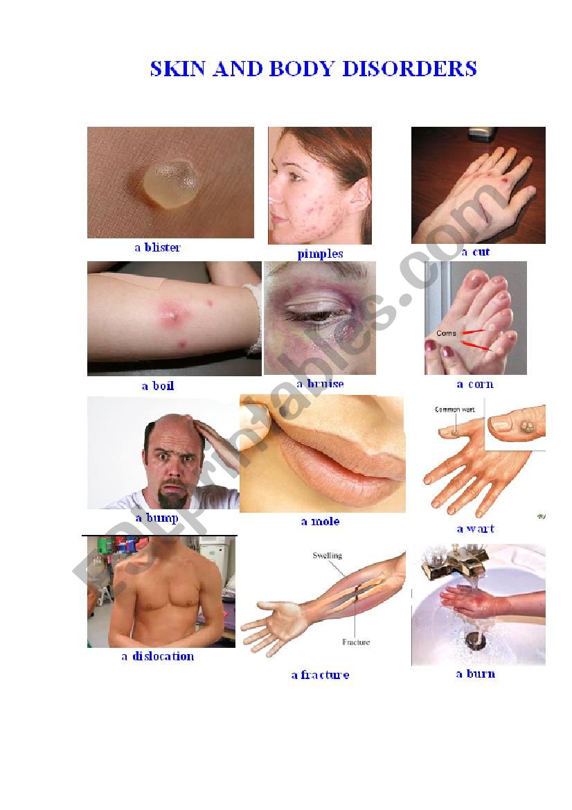 Skin and Body Disorders worksheet